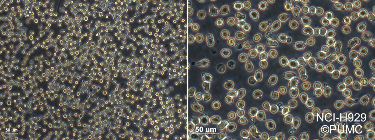NCI-H929人浆细胞白血病细胞图片