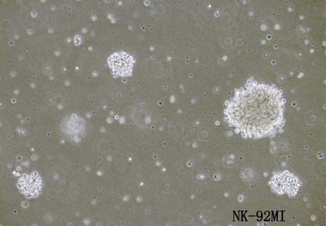NK-92MI [NK92MI]人恶性非霍奇金淋巴瘤患者的自然杀伤细胞图片