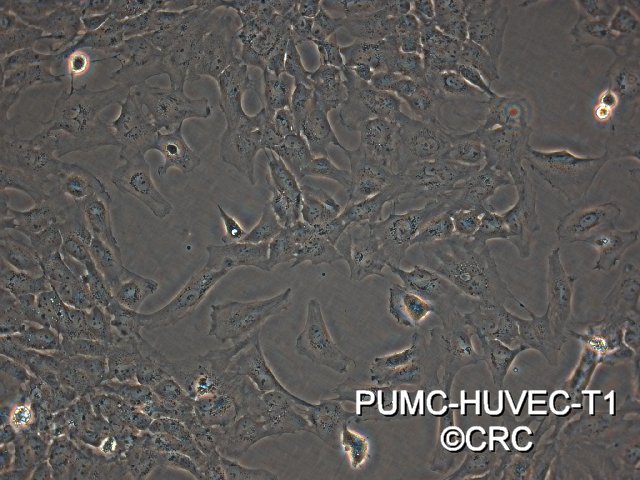 PUMC-HUVEC-T1 SV40T转化人脐静脉内皮细胞图片