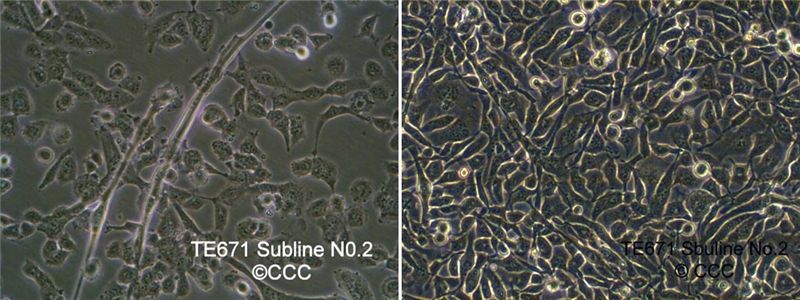 TE671 Subline No.2人横纹肌肉瘤细胞图片