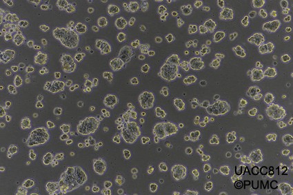 UACC812人乳腺导管瘤细胞图片