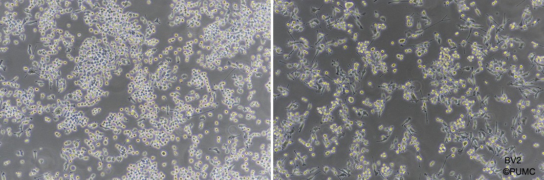 BV2小鼠小胶质细胞图片