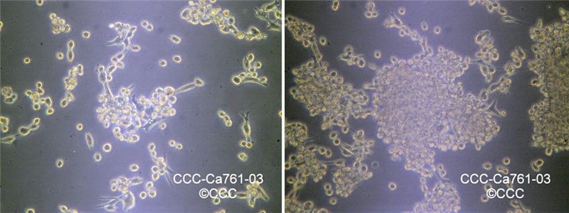 CCC-Ca761-03小鼠乳腺癌细胞图片