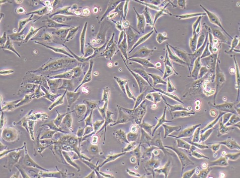 SW620/GFP(人结肠癌细胞(绿色荧光蛋白标记))(L15)(STR鉴定正确)图片