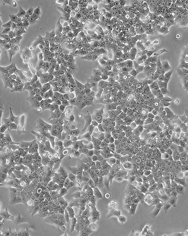 HSC-2口腔鳞状肿瘤细胞图片