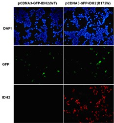 IDH2(R172W)С󵥿ͼƬ