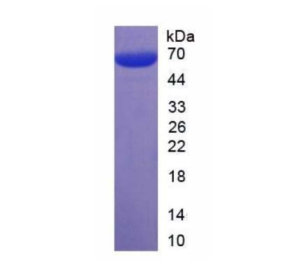 重组CD20样蛋白图片
