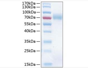 重组COX8A蛋白图片