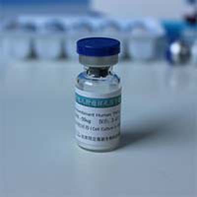 重组LHFPL2蛋白图片