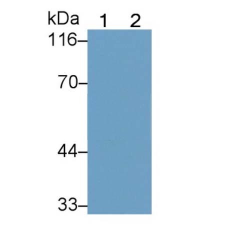 Ⅳ型胶原α4(COL4a4)抗体图片