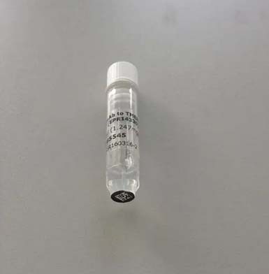 早期发育调控蛋白2/HDC2抗体图片