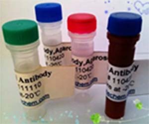 含黄素单加氧酶1(FMO1)抗体图片