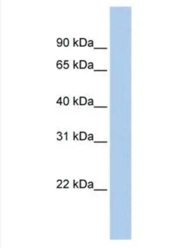 OR13C5抗体图片