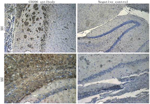 CD206 antibody,orb4941图片