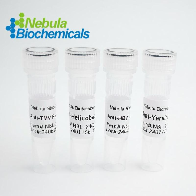 NebuSelect™ZIKA virus (ZIKV) ENS5 Africa Pseudovirus [Antigen]图片