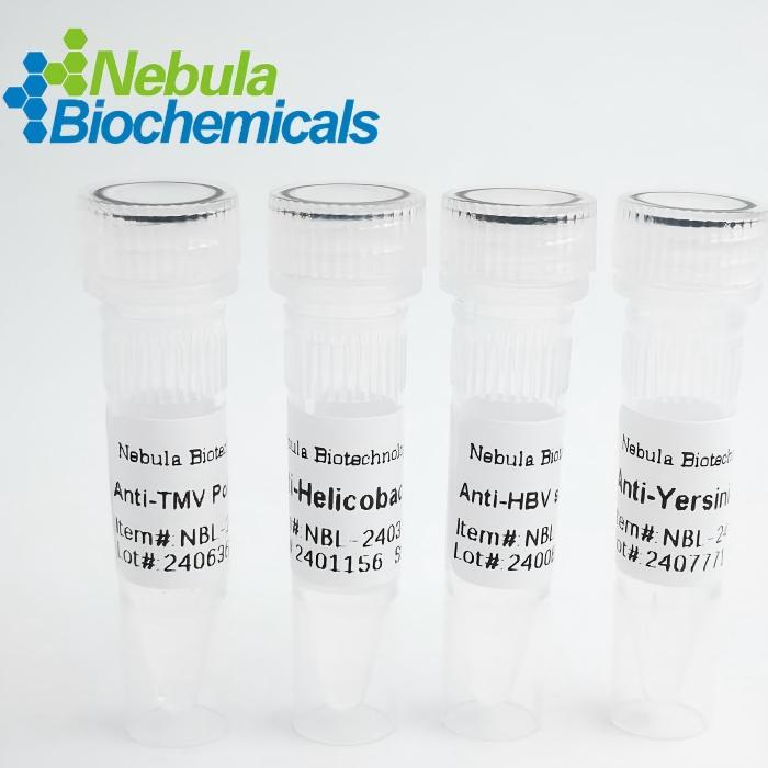 NebuSelect™ZIKA virus (ZIKV) ENS5 Asian Pseudovirus [Antigen]图片