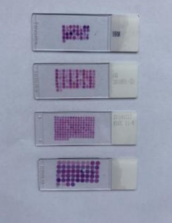 直肠癌与自体癌旁配对生物芯片图片