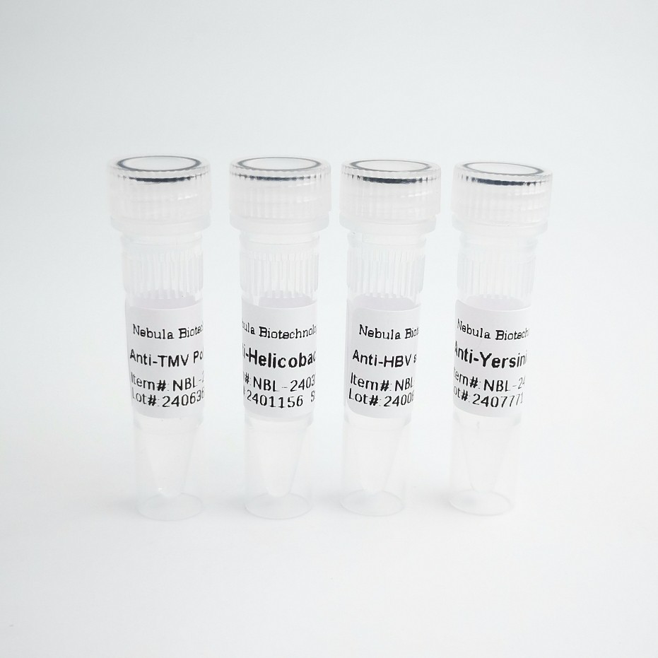 NebuSelect™Anti-Chikungunya Virus (CHIKV) Polyclonal Antibody图片