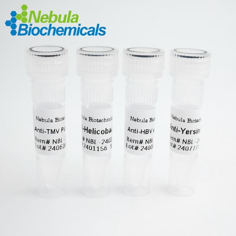 NebuSelect™Recombinant Chikungunya E1图片