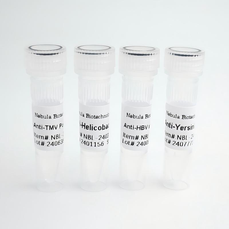 NebuSelect™Anti-Chikungunya Virus E3 (CHIKV) Polyclonal Antibody图片