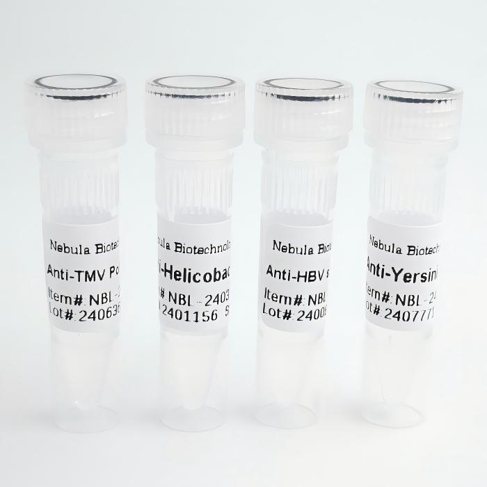 NebuSelect™Recombinant Chikungunya Virus protein, 810-1248aa, His-tag图片
