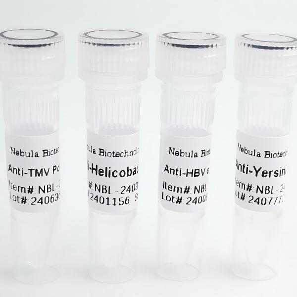 NebuSelect™Recombinant Chikungunya E2图片
