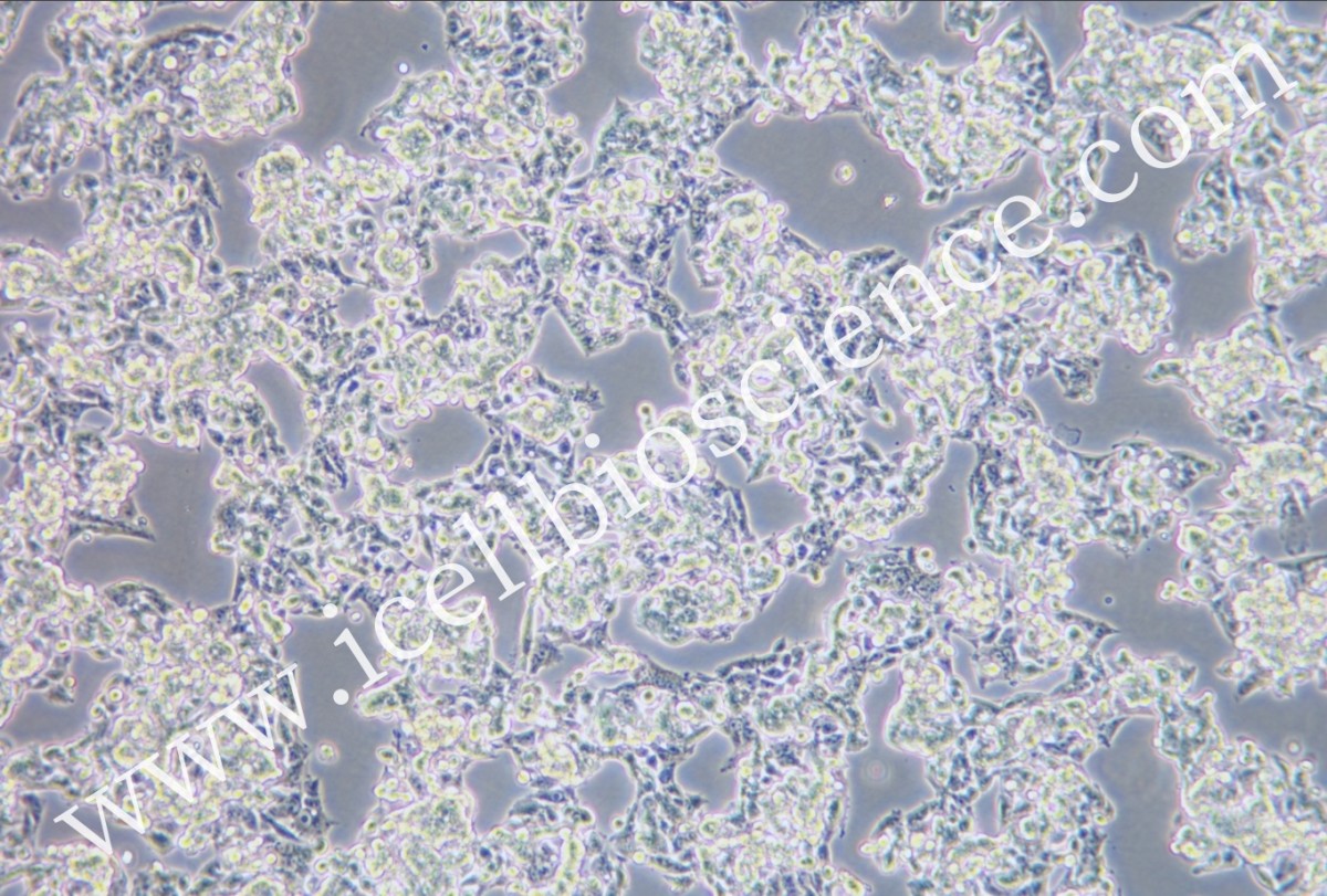 HepG2人肝癌细胞图片