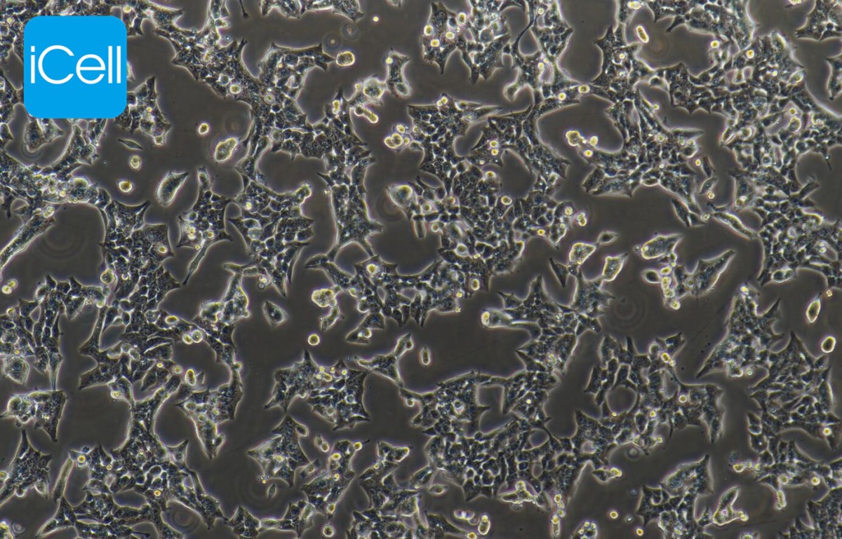 HCT-116人结肠癌细胞图片