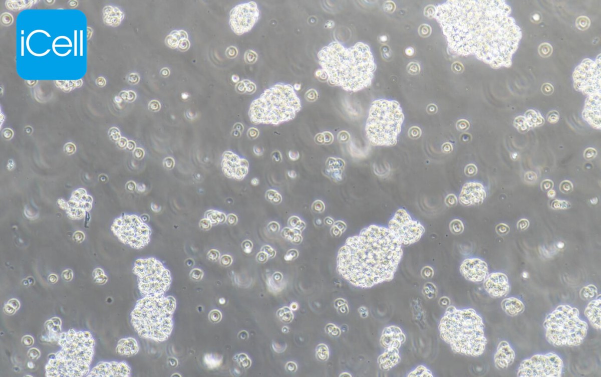 Jurkat(clone E6-1)人T淋巴细胞白血病细胞图片