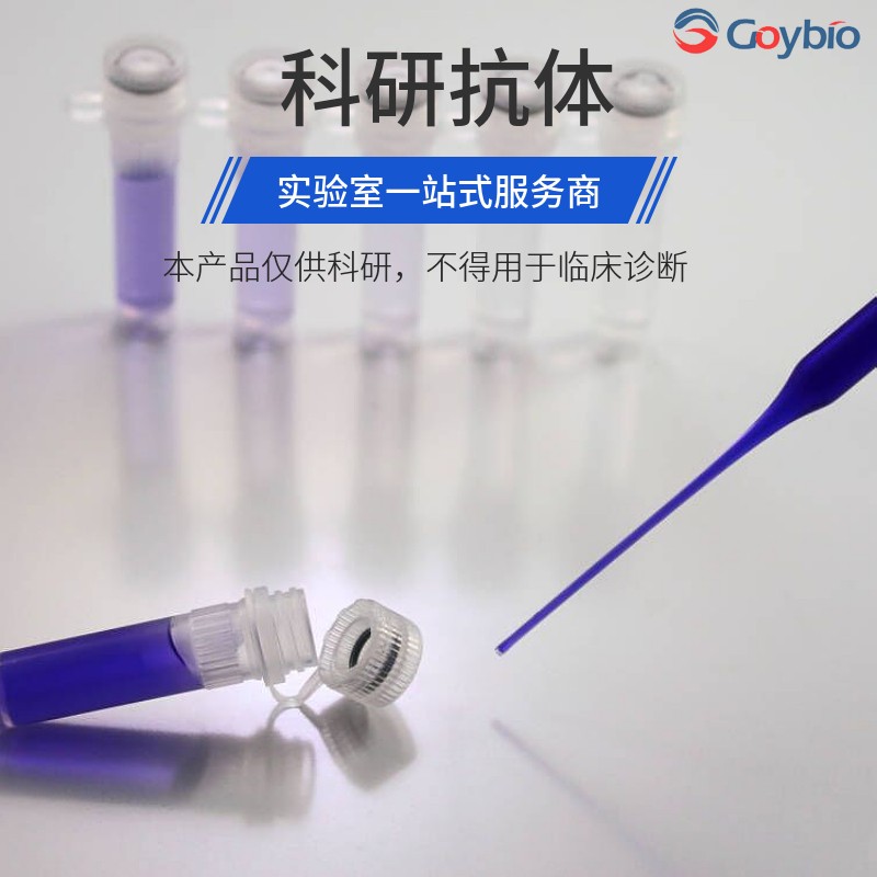 抑癌基因p16重组兔单抗图片