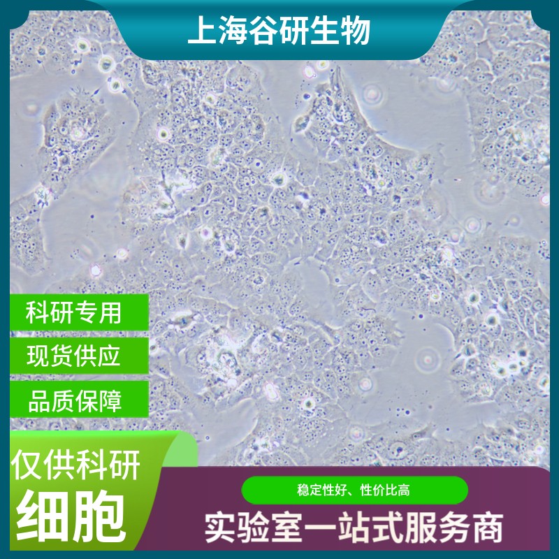 鸡卵泡颗粒细胞图片