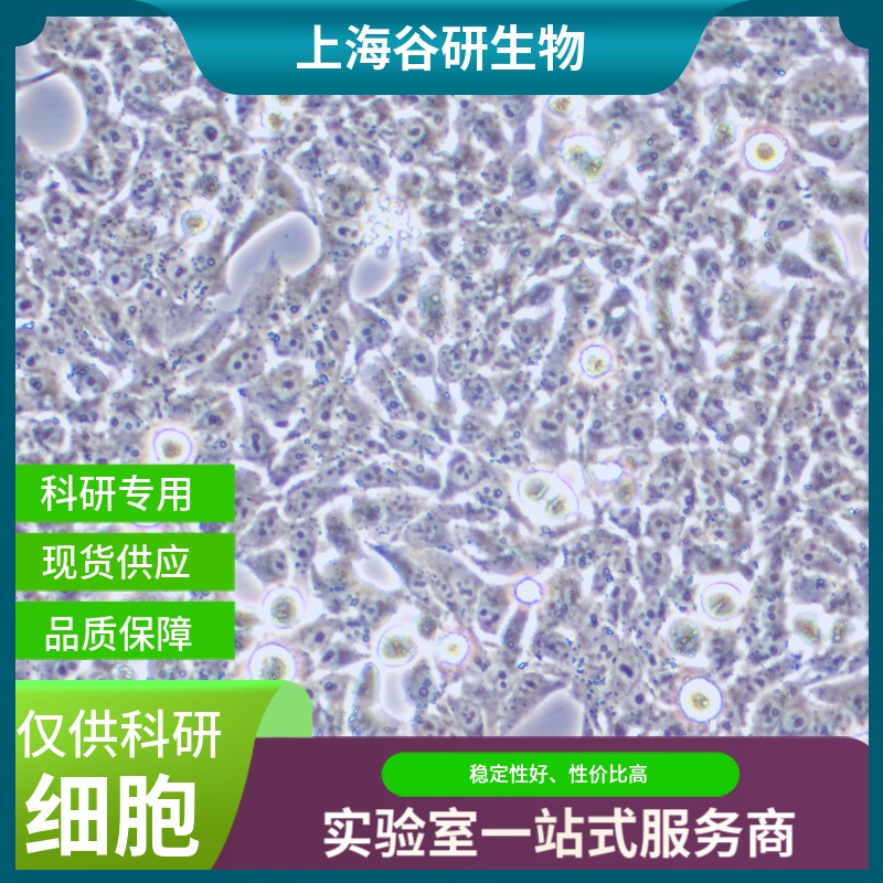 大鼠胰腺星状细胞图片