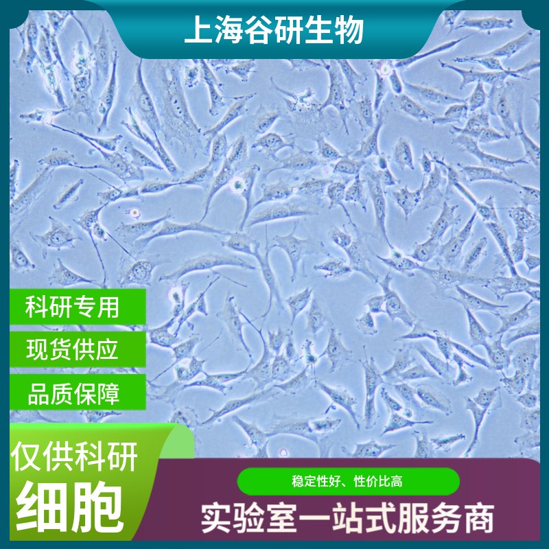 大鼠子宫内膜基质细胞图片