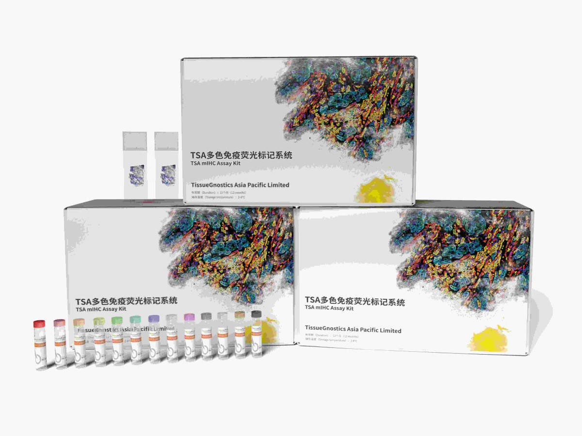 高能TSA多重免疫组化检测试剂盒图片