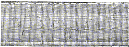 2-Heptenic aldehyde光谱图1