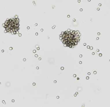 Raji,人Burkitt's淋巴瘤细胞图片