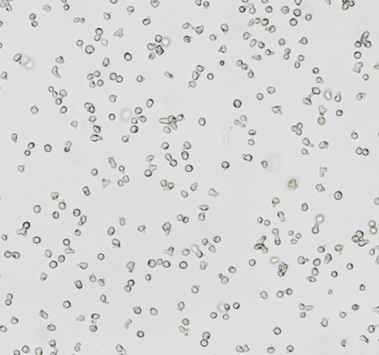 Ramos (RA 1),人B淋巴细胞瘤细胞图片